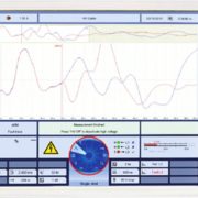 tdr-teleflex-vx-in-koffer